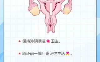 安全吗 节育环取出前后的注意事项及医生建议，夫妻必读指南