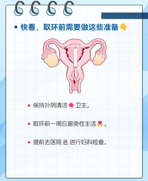 安全吗 节育环取出前后的注意事项及医生建议，夫妻必读指南-第1张图片-拼多多助力